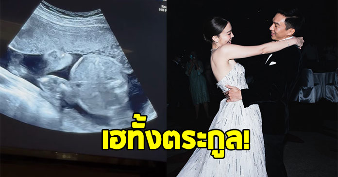 ดาราทั้งวงการแห่ยินดี ! ไฮโซสาวหมื่นล้าน ประกาศข่าวดีท้องแล้วจ้า